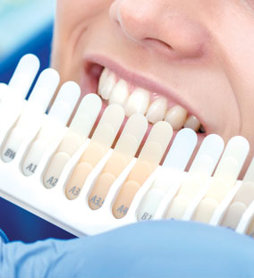 Esthetische tandheelkunde